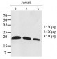 RAC1 + RAC2 Antibody (clone AT2G11)